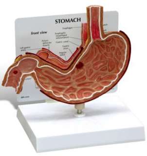 Stomach w/ Ulcers Anatomy/Anatomical Organ Model #2000  